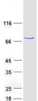 FRMD8 Protein - Purified recombinant protein FRMD8 was analyzed by SDS-PAGE gel and Coomassie Blue Staining