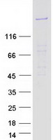 FRMPD4 Protein - Purified recombinant protein FRMPD4 was analyzed by SDS-PAGE gel and Coomassie Blue Staining