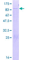 FRS3 Protein - 12.5% SDS-PAGE of human FRS3 stained with Coomassie Blue