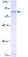 FSAP57 / SMU1 Protein - 12.5% SDS-PAGE of human SMU1 stained with Coomassie Blue