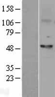 FSCN1 / Fascin Protein - Western validation with an anti-DDK antibody * L: Control HEK293 lysate R: Over-expression lysate