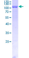 FSCN1 / Fascin Protein - 12.5% SDS-PAGE Stained with Coomassie Blue