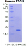 FSCN1 / Fascin Protein - Recombinant Fascin By SDS-PAGE