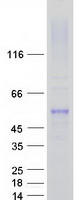 FSCN1 / Fascin Protein - Purified recombinant protein FSCN1 was analyzed by SDS-PAGE gel and Coomassie Blue Staining