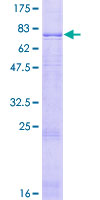 FSCN3 Protein - 12.5% SDS-PAGE of human FSCN3 stained with Coomassie Blue