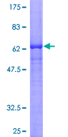 FSD1 Protein - 12.5% SDS-PAGE of human FSD1 stained with Coomassie Blue