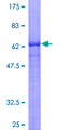 FSD1 Protein - 12.5% SDS-PAGE of human FSD1 stained with Coomassie Blue