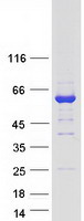 FSD1 Protein - Purified recombinant protein FSD1 was analyzed by SDS-PAGE gel and Coomassie Blue Staining
