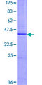 FSD1L Protein - 12.5% SDS-PAGE of human FSD1L stained with Coomassie Blue
