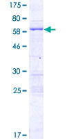FSD1L Protein - 12.5% SDS-PAGE of human FSD1L stained with Coomassie Blue