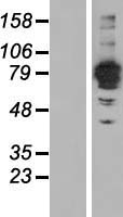 FSD2 Protein - Western validation with an anti-DDK antibody * L: Control HEK293 lysate R: Over-expression lysate