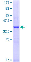 FSH Receptor / FSHR Protein - 12.5% SDS-PAGE Stained with Coomassie Blue.