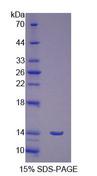 FSH Receptor / FSHR Protein - Recombinant Follicle Stimulating Hormone Receptor By SDS-PAGE