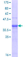 FSHB / FSH Beta Protein - 12.5% SDS-PAGE Stained with Coomassie Blue.
