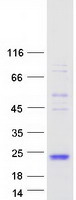 FSHB / FSH Beta Protein - Purified recombinant protein FSHB was analyzed by SDS-PAGE gel and Coomassie Blue Staining
