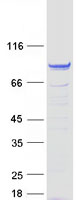 FSIP1 Protein - Purified recombinant protein FSIP1 was analyzed by SDS-PAGE gel and Coomassie Blue Staining