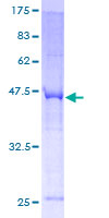 FSP27 / CIDEC Protein - 12.5% SDS-PAGE of human CIDEC stained with Coomassie Blue