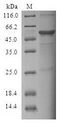 FSP27 / CIDEC Protein - (Tris-Glycine gel) Discontinuous SDS-PAGE (reduced) with 5% enrichment gel and 15% separation gel.