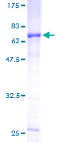 FST / Follistatin Protein - 12.5% SDS-PAGE of human FST stained with Coomassie Blue