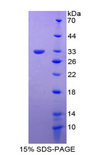 FST / Follistatin Protein - Recombinant Follistatin By SDS-PAGE