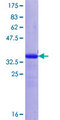 FSTL1 Protein - 12.5% SDS-PAGE Stained with Coomassie Blue.