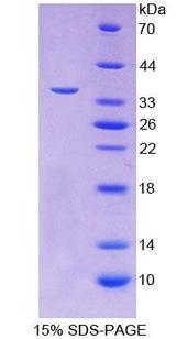 FSTL1 Protein - Recombinant  Follistatin Like Protein 1 By SDS-PAGE