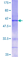 FSTL3 / FLRG Protein - 12.5% SDS-PAGE of human FSTL3 stained with Coomassie Blue