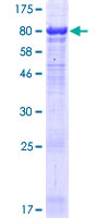 FSTL4 Protein - 12.5% SDS-PAGE of human FSTL4 stained with Coomassie Blue