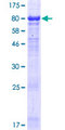 FSTL4 Protein - 12.5% SDS-PAGE of human FSTL4 stained with Coomassie Blue