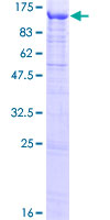 FSTL5 Protein - 12.5% SDS-PAGE of human FSTL5 stained with Coomassie Blue