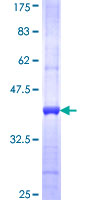 FTCD / 58K Golgi Protein Protein - 12.5% SDS-PAGE Stained with Coomassie Blue.