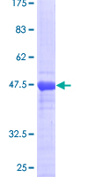 FTH1 / Ferritin Heavy Chain Protein - 12.5% SDS-PAGE of human FTH1 stained with Coomassie Blue