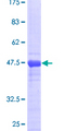 FTH1 / Ferritin Heavy Chain Protein - 12.5% SDS-PAGE of human FTH1 stained with Coomassie Blue