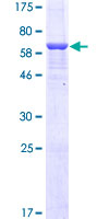 FTHFSDC1 / MTHFD1L Protein - 12.5% SDS-PAGE of human MTHFD1L stained with Coomassie Blue