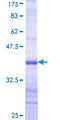 FTHFSDC1 / MTHFD1L Protein - 12.5% SDS-PAGE Stained with Coomassie Blue.