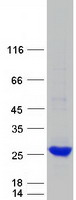 FTHL17 Protein - Purified recombinant protein FTHL17 was analyzed by SDS-PAGE gel and Coomassie Blue Staining