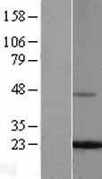 FTL / Ferritin Light Chain Protein - Western validation with an anti-DDK antibody * L: Control HEK293 lysate R: Over-expression lysate
