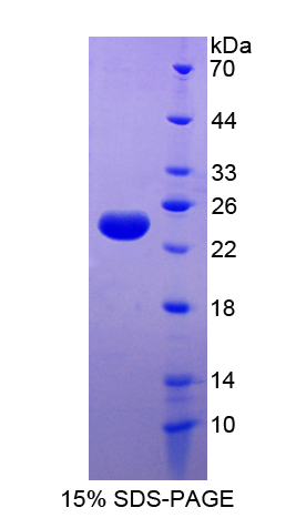 FTL / Ferritin Light Chain Protein - Recombinant  Ferritin, Light Polypeptide By SDS-PAGE