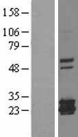 FTMT / MTF Protein - Western validation with an anti-DDK antibody * L: Control HEK293 lysate R: Over-expression lysate