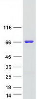 FTO Protein - Purified recombinant protein FTO was analyzed by SDS-PAGE gel and Coomassie Blue Staining