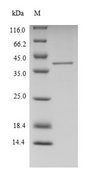 FTSJ1 Protein - (Tris-Glycine gel) Discontinuous SDS-PAGE (reduced) with 5% enrichment gel and 15% separation gel.