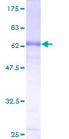 FTSJ1 Protein - 12.5% SDS-PAGE of human FTSJ1 stained with Coomassie Blue