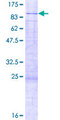 FTSJ3 Protein - 12.5% SDS-PAGE of human FTSJ3 stained with Coomassie Blue