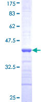 FUBP1 Protein - 12.5% SDS-PAGE Stained with Coomassie Blue.