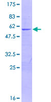 FUBP3 Protein - 12.5% SDS-PAGE of human FUBP3 stained with Coomassie Blue