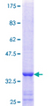 FUCA2 Protein - 12.5% SDS-PAGE Stained with Coomassie Blue.