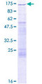 FUK Protein - 12.5% SDS-PAGE of human FUK stained with Coomassie Blue
