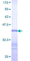 FUK Protein - 12.5% SDS-PAGE Stained with Coomassie Blue.