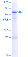 FUT1 / HSC Protein - 12.5% SDS-PAGE of human FUT1 stained with Coomassie Blue