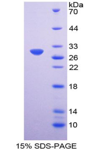 FUT3 Protein - Recombinant  Fucosyltransferase 3 By SDS-PAGE